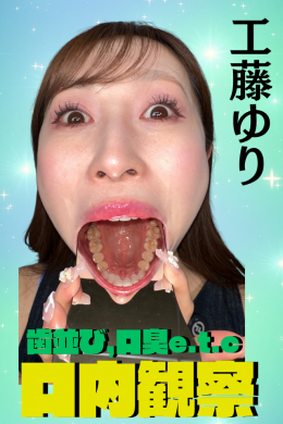 工藤ゆり【口内観察（歯並び＆口臭編）】