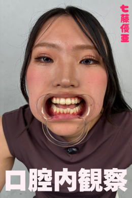 七藤優亜【口腔内観察】