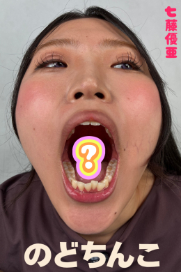 【七藤優亜【のどちんこ観察】】
七藤優亜【のどちんこ観察】