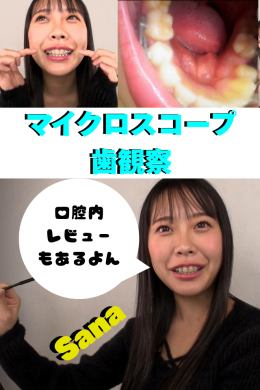 【Sana【マイクロスコープ歯観察】】
Sana【マイクロスコープ歯観察】
