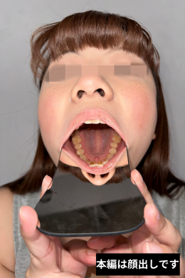 【みみの口内観察後の口臭嗅がせ】
みみちゃんのお口の中はどうなってるのかな～！？お肌もちもちのみみちゃんの口内を観察して、口臭をたっぷり吐き掛けてもらいました！
主観映像で自分が吐き掛けられているかのような体験を堪能あれ！