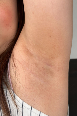 【褐色に変色した腋の匂い嗅いでみる？みみの腋鑑賞】
みみさんの蒸れた腋の匂いを嗅いでみたい…。夏場で蒸れ気味の腋を鑑賞後、迫りくる腋を感じる動画です。