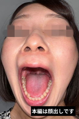 【独白からの口臭かがせ　うみ】
おもむろに自身の口臭について語りだすうみさん。独特な空気感をまとっているうみさん。自作のセリフを朗読してもらい世界観を演出してもらいました。朗読も独特で聞けば聞くほど癖になる！？
第二部は口臭嗅がせ‼濃厚な口臭をたっぷり吐き掛けてくれます！