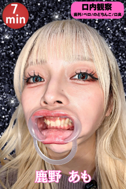 【鹿野あもちゃんfeti072初登場‼あもちゃんの口内はどうなってんの⁉】
鹿野あもちゃんの口内を解体していく‼
まずはのどちんこをマイクロスコープで覗いてみるが。。あもちゃん
口があまり大きく開くのが苦手のようで撮影に大苦戦（汗）
その他
・ベロ観察（長さ測定）
・歯列観察
・口臭チェック

口臭チェッカーを使っての数値が…