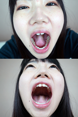 フェチ：レズ：今村加奈子ちゃんの歯・口内自撮り